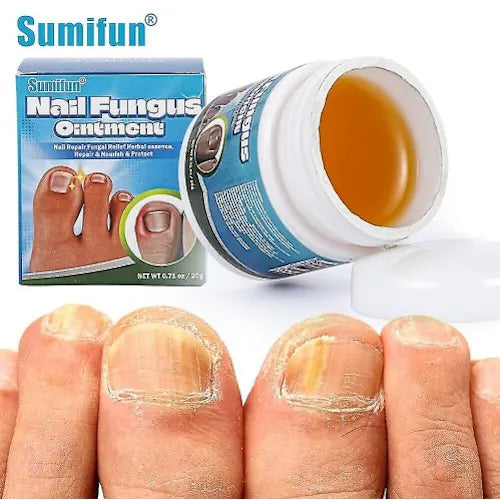 Sumifun Nail Repair Ointment – Fungal Treatment & Nail Restoration